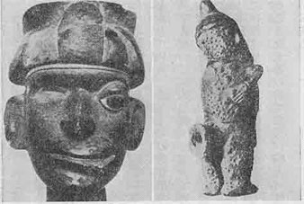 uFig 31 Peruvian Huaco: Facial paralysis (left) & Skin disease (right).@}31@y[̃RFʖჁijA畆aiEjṽLvVt̐}