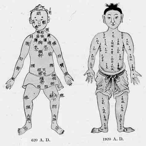 「第10図(左)第11図(右)中国の鍼療法の図 1300年の間(紀元620-1920)、持続している」のキャプション付きの図